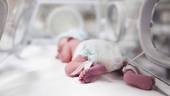 Neonati prematuri: Osp. Bambino Gesù, intervento salvavita in enodinamica su bimbo nato alla 25ª settimana